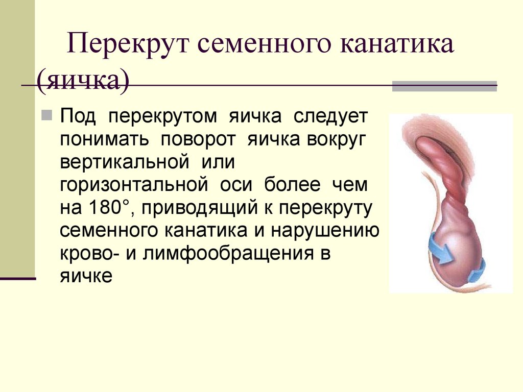 Перекрут яичка карта вызова