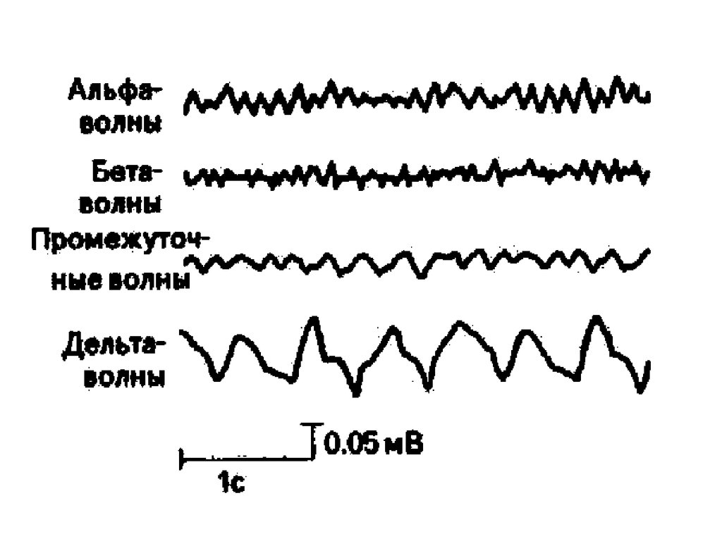 Альфа волны. Дельта волны на ЭЭГ. Бета волны на ЭЭГ частота.