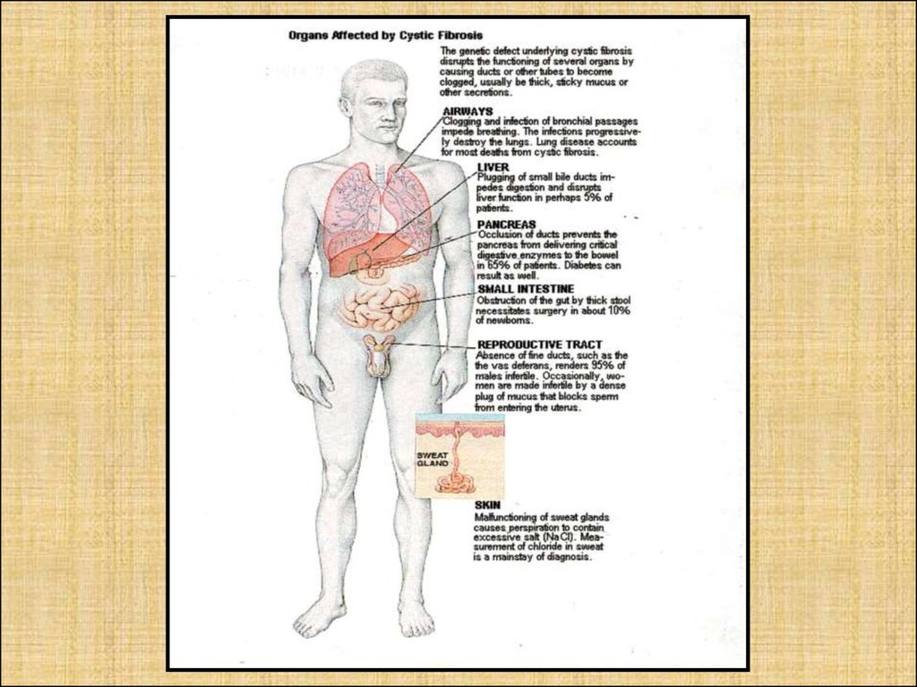 Муковисцидоз презентация по генетике