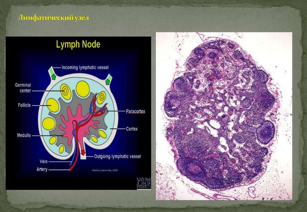 Лимфоузлы структурны. Лимфатические узлы. Строение лимфатического узла. Строение лимфатического узла анатомия. Лимфоидные узелки.