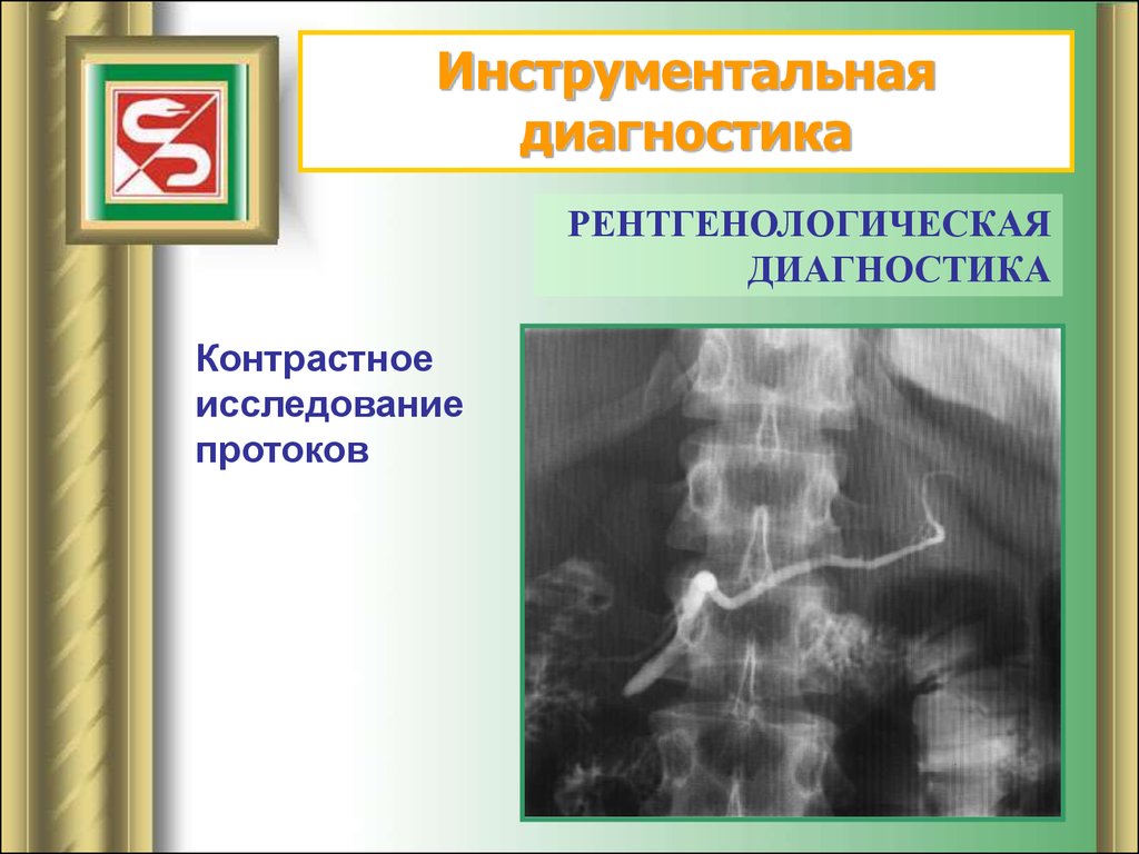 Исследования острого панкреатита. Инструментальные исследования острого панкреатита. Инструментальные методы исследования острого панкреатита. Диагностика острого панкреатита хирургия. Острый панкреатит Факультетская хирургия.