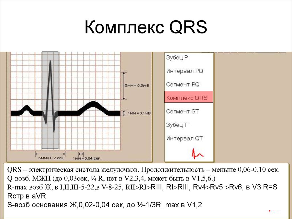 Зубцы экг в норме. Комплекс зубцов QRS на ЭКГ. ЭКГ комплекс QRS В v2. Комплекс QRS на ЭКГ норма. Отрицательный зубец р после QRS комплекса.