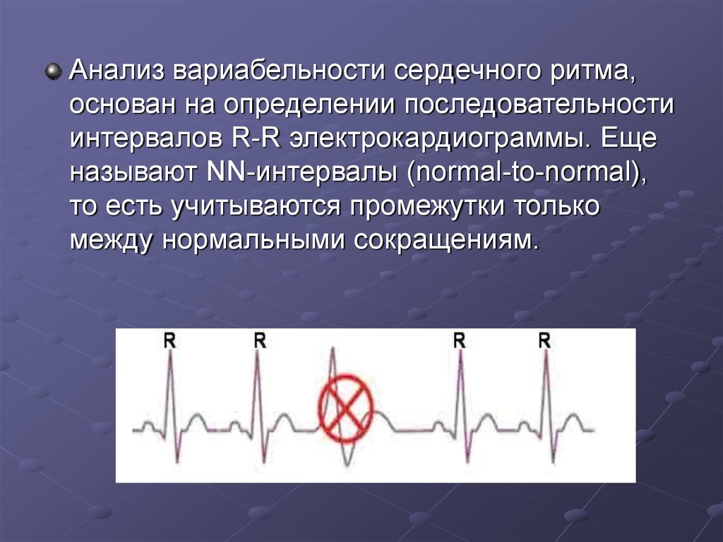 Вариабельность ритма сердца. Вариабельность сердечного ритма. Вариабельность ритма сердца исследование. Анализ вариабельности сердечного ритма. Что такое метод вариабельности сердечного ритма.