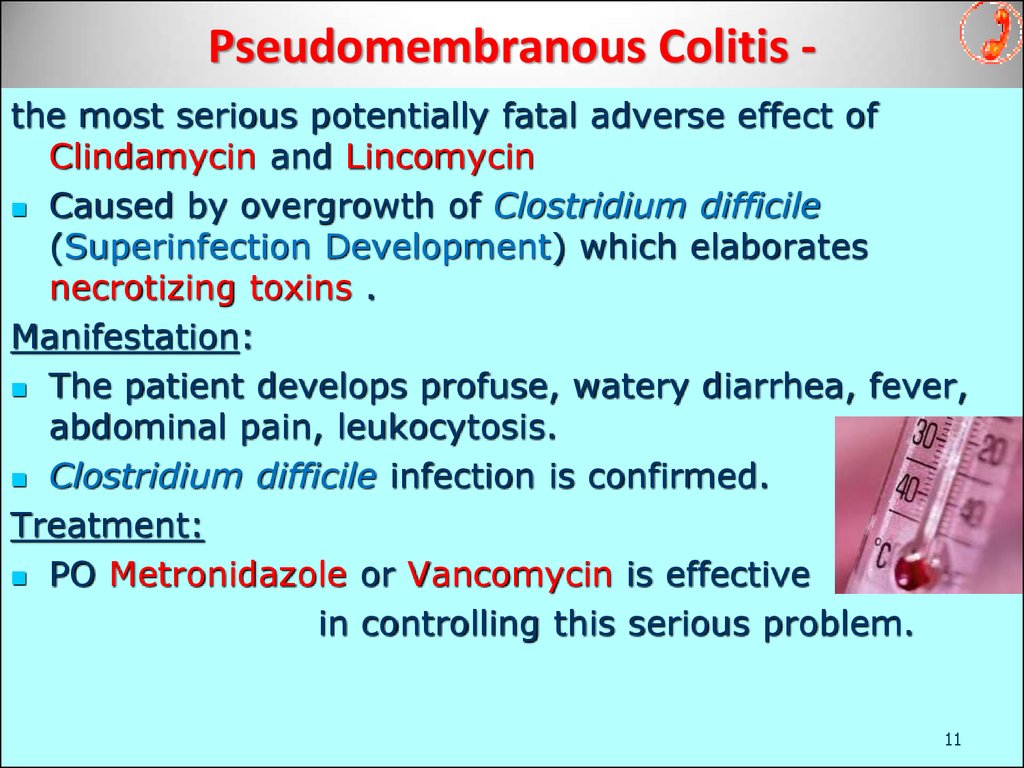 Pseudomembranous Colitis -