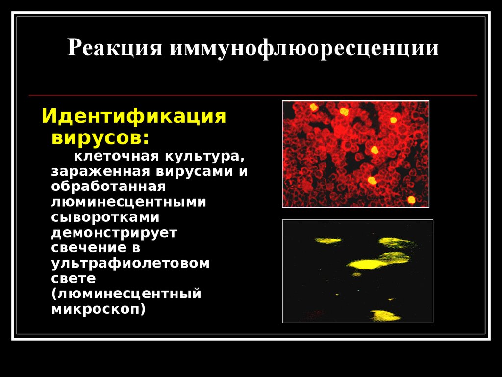 Называют обладают флюоресцируют. Иммунофлюоресцентный метод вирусы. Реакция иммунофлюоресценции микробиология. Непрямой иммунофлюоресцентный метод. Реакция непрямой иммунофлюоресценции.