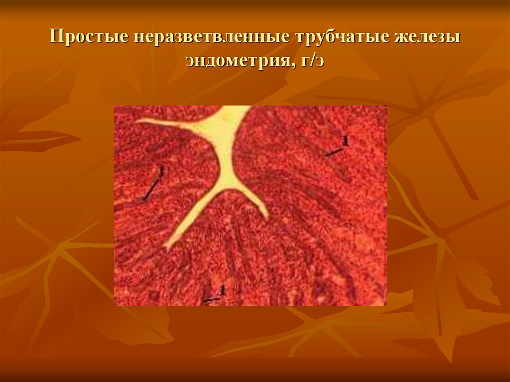 Простые трубчатые. Простая неразветвленная железа. Простая трубчатая неразветвленная. . Простые трубчатые неразветвленные железы эндометрия. Простая трубчатая железа.