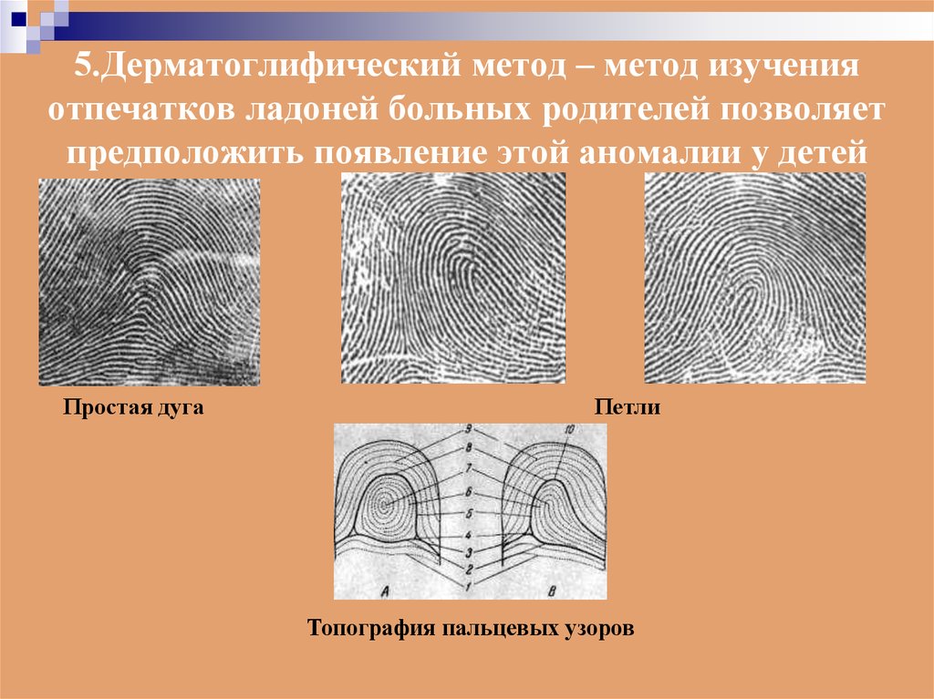 Дерматоглифический метод презентация