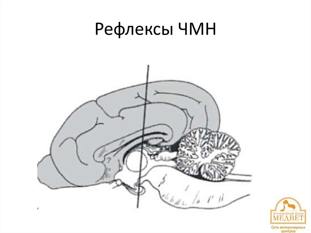Рефлексы ЧМН