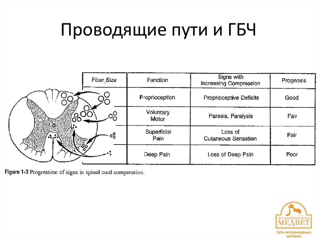 Проводящие пути и ГБЧ