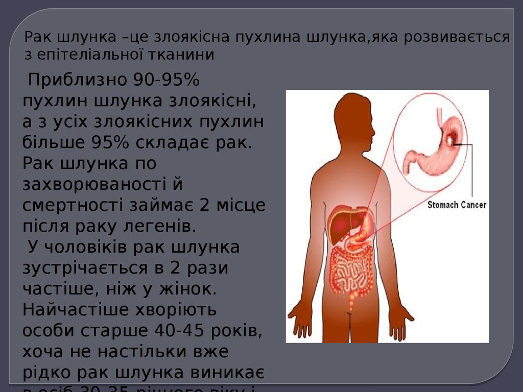 Онкология рак реферат. Женская онкология доклад.