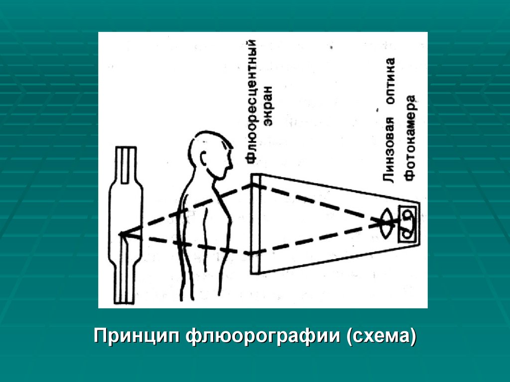 Принципы получения изображения. Методы рентгенодиагностики схема. Принцип флюорографии. Схема флюорографа. Флюорография схема.