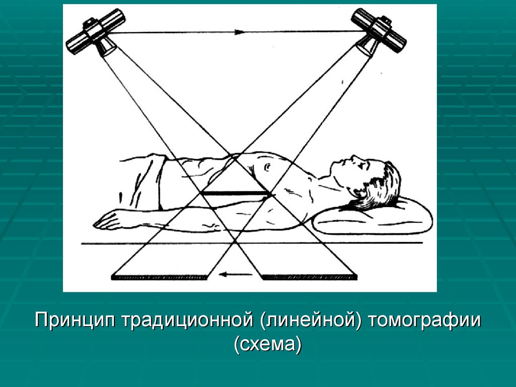 Укладки в рентгенологии в картинках и с описанием для начинающих