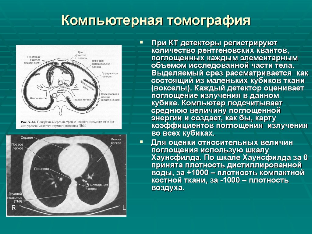 Компьютерная томография определяет