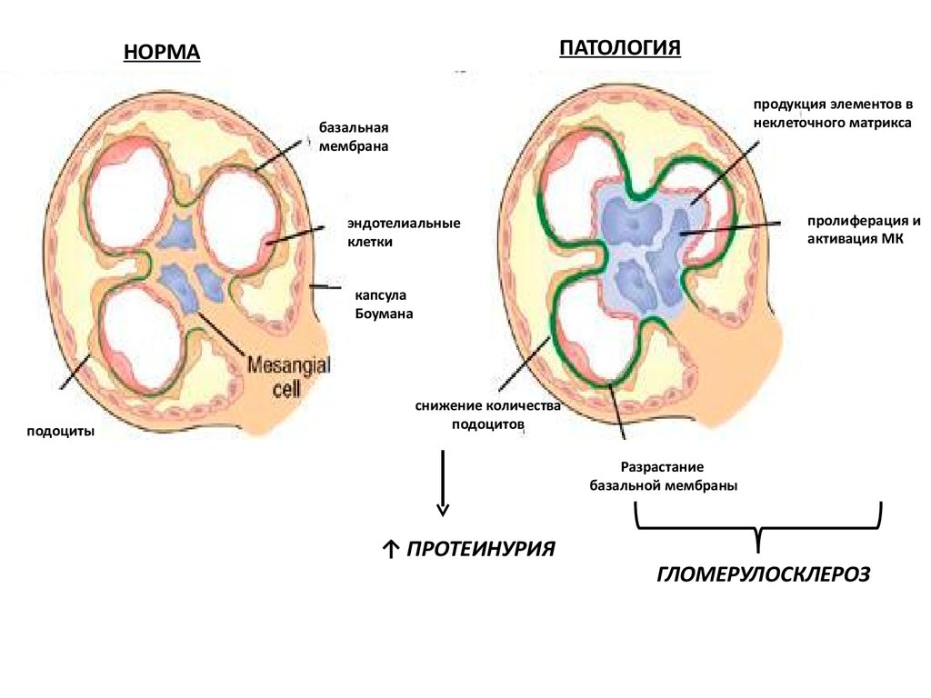 Базальная мембрана клубочка. Базальная мембрана клубочка гистология. Базальная мембрана клубочка почки. Строение базальной мембраны почки. Тонких базальных мембран.