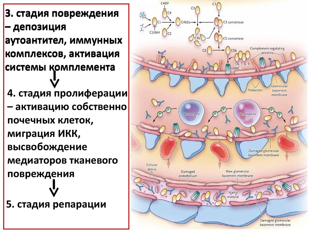 3 степень ранения. Иммунная карта ЖКТ. Иммунный комплекс. Стадии пролиферации. Иммунные комплексы в почках.