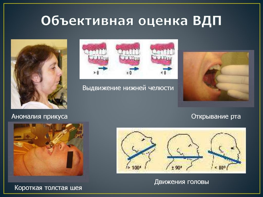 Объективная оценка ВДП