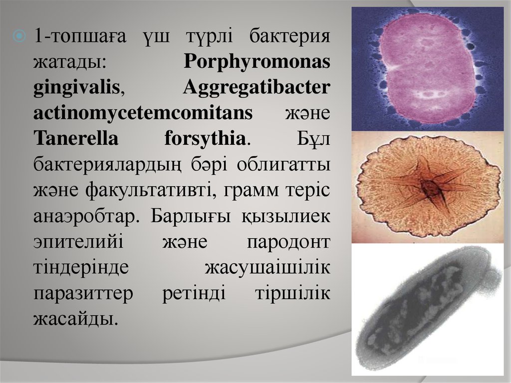 Porphyromonas gingivalis. Aggregatibacter actinomycetemcomitans. Порфиромонады. Порфиромонада Гингивалис. E. gingivalis морфология паразита.