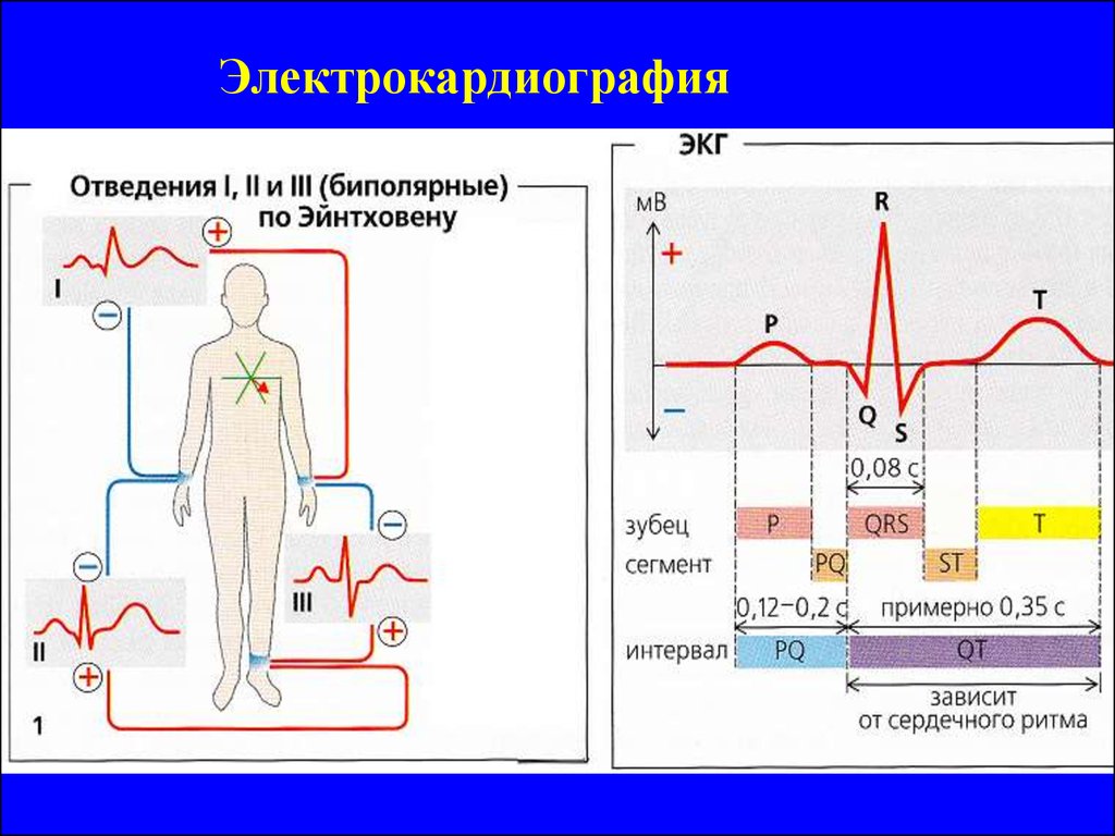 Экг схема рисунок