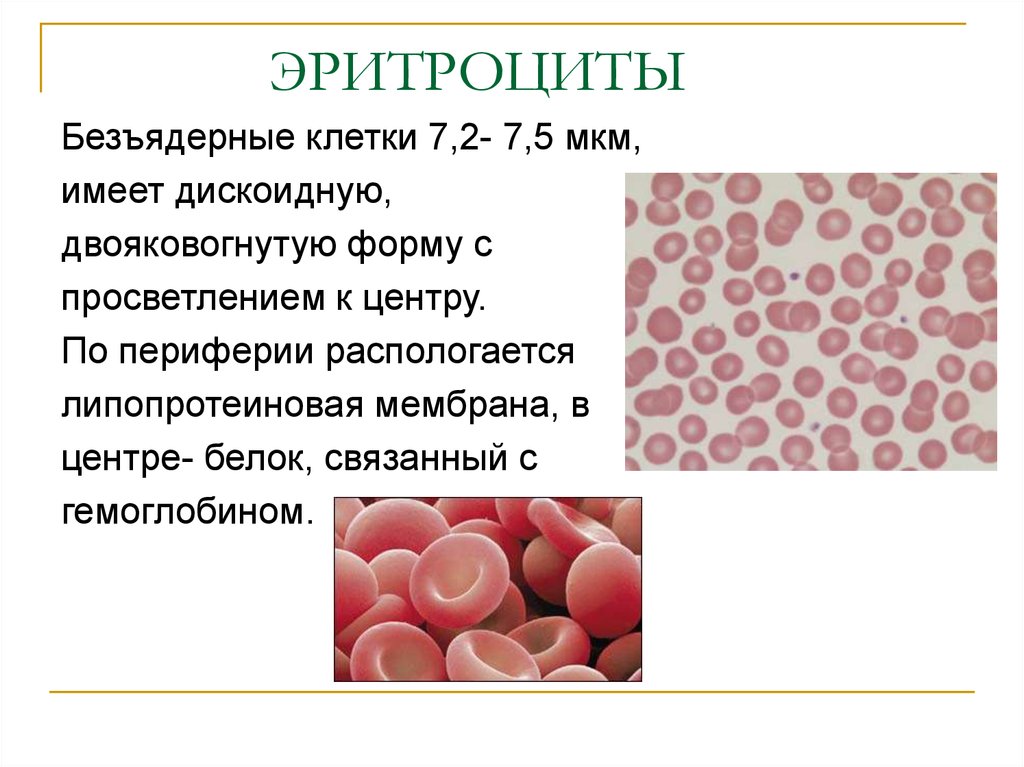 Морфологические изменения в эритроцитах рисунок