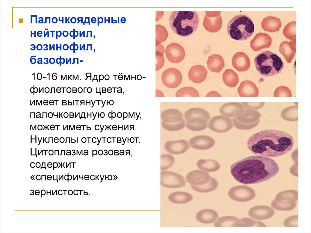 Палочкоядерные. Палочкоядерные нейтрофилы функции. Палочкоядерные нейтрофилы зернистость. Функции палочкоядерных нейтрофилов. Функции палочкоядерных лейкоцитов.