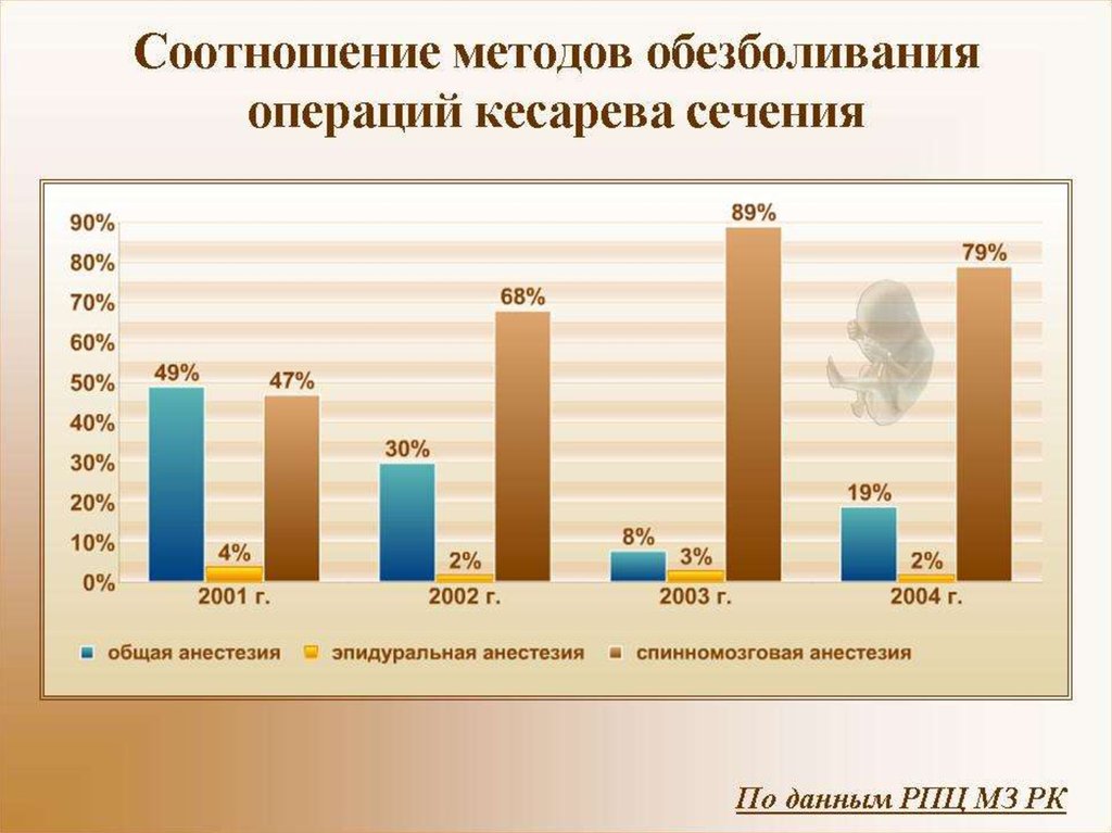 Статистика родов. Статистические данные кесарево сечения. Статистика по кесареву сечению в России. Статистика Кесова сечения в России. Росстат статистика кесарево сечения.