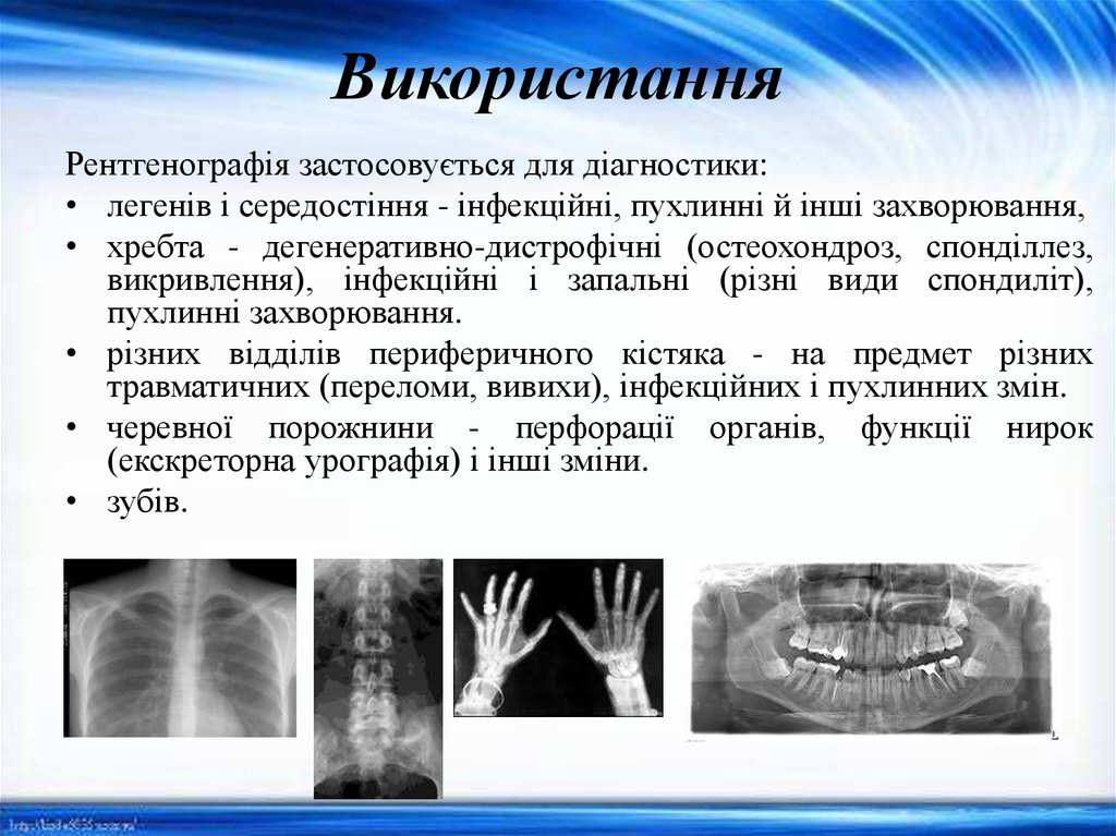 Використання