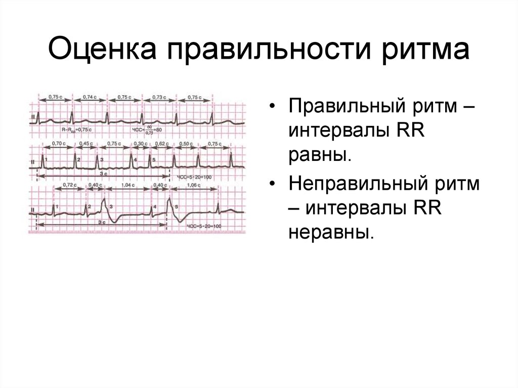 Какая структура ритма отражает перекрестную схему ползания