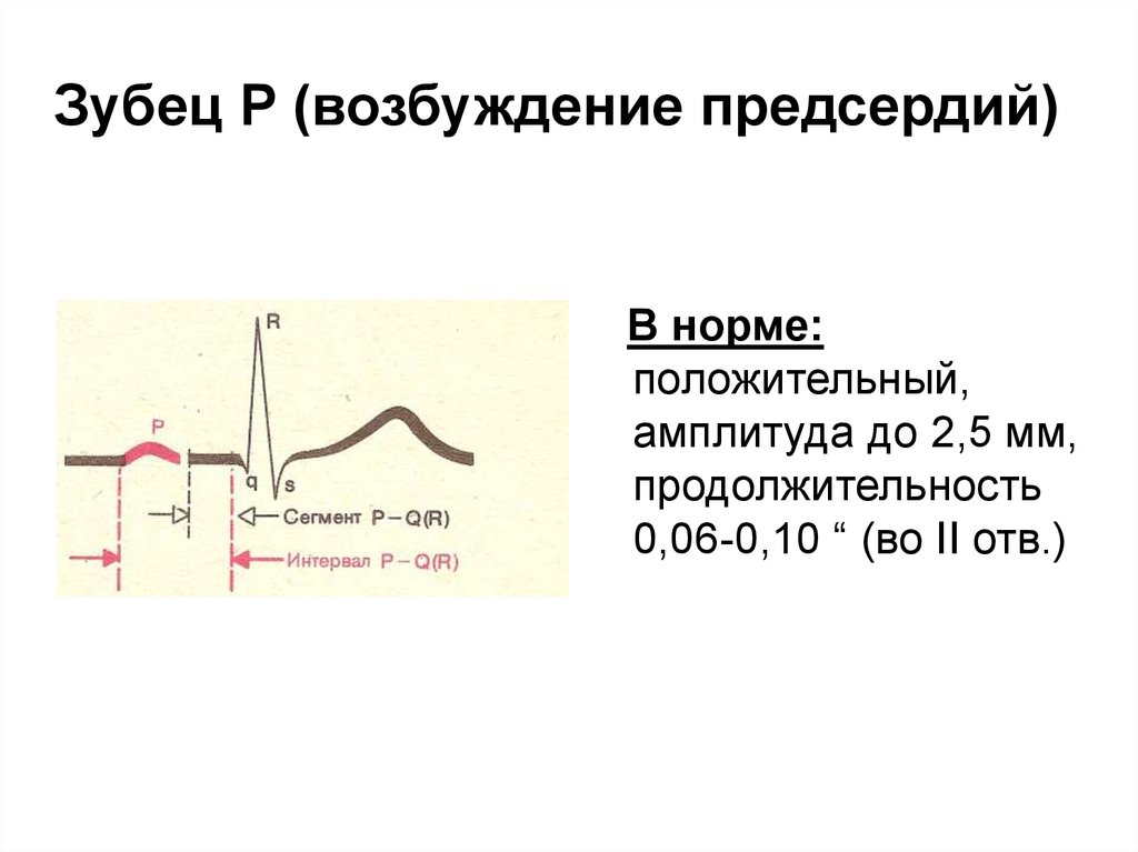 Возбуждение п. Двухфазный зубец р на ЭКГ В норме. Норма зубца р на ЭКГ. Норма зубца p на ЭКГ. Норма амплитуды зубца p.