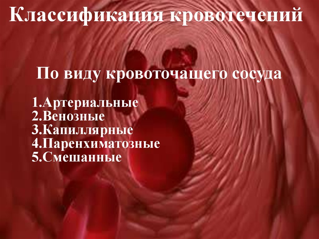 Помощь при смешанном кровотечении. Паренхиматозное кровотечение. Паренхиматозного капиллярного артериального венозного. Артериальное венозное капиллярное и паренхиматозное кровотечение. Паренхиматозное кровотечение признаки.