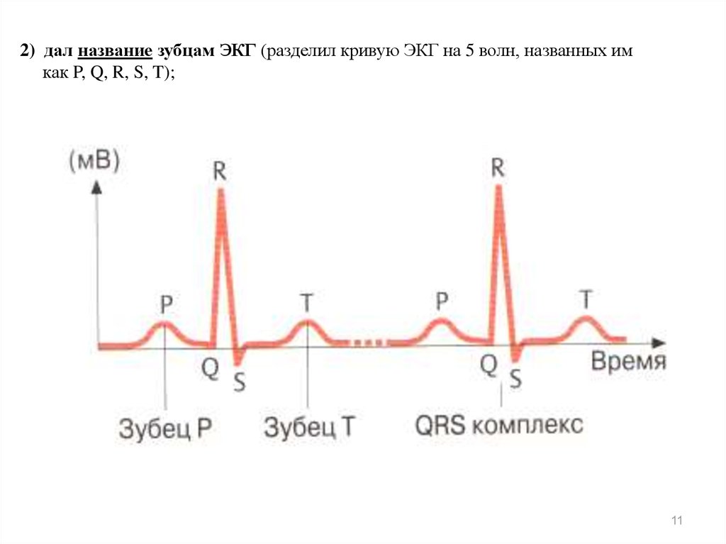 Зубцы экг. Схема ЭКГ И название зубцов. ПАТ зубец q на ЭКГ. Зубцы ЭКГ названия. Зубцы электрокардиограммы.