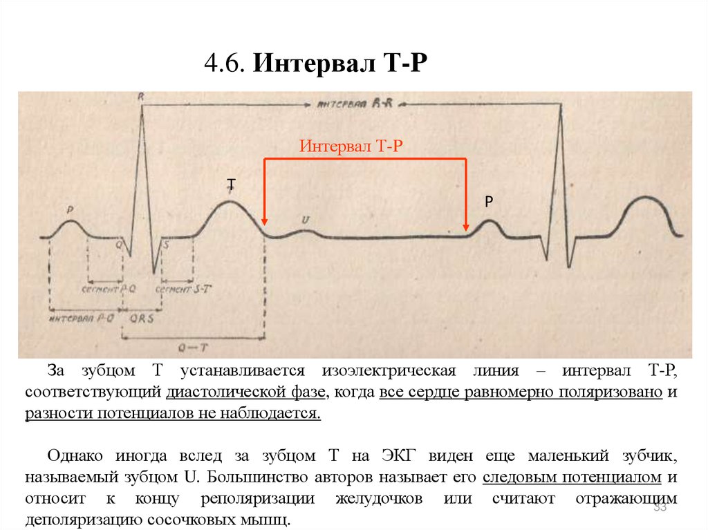 T интервал. Изоэлектрическая линия на ЭКГ это. Интервал т–р. Изоэлектрический интервал. Диастолический интервал.