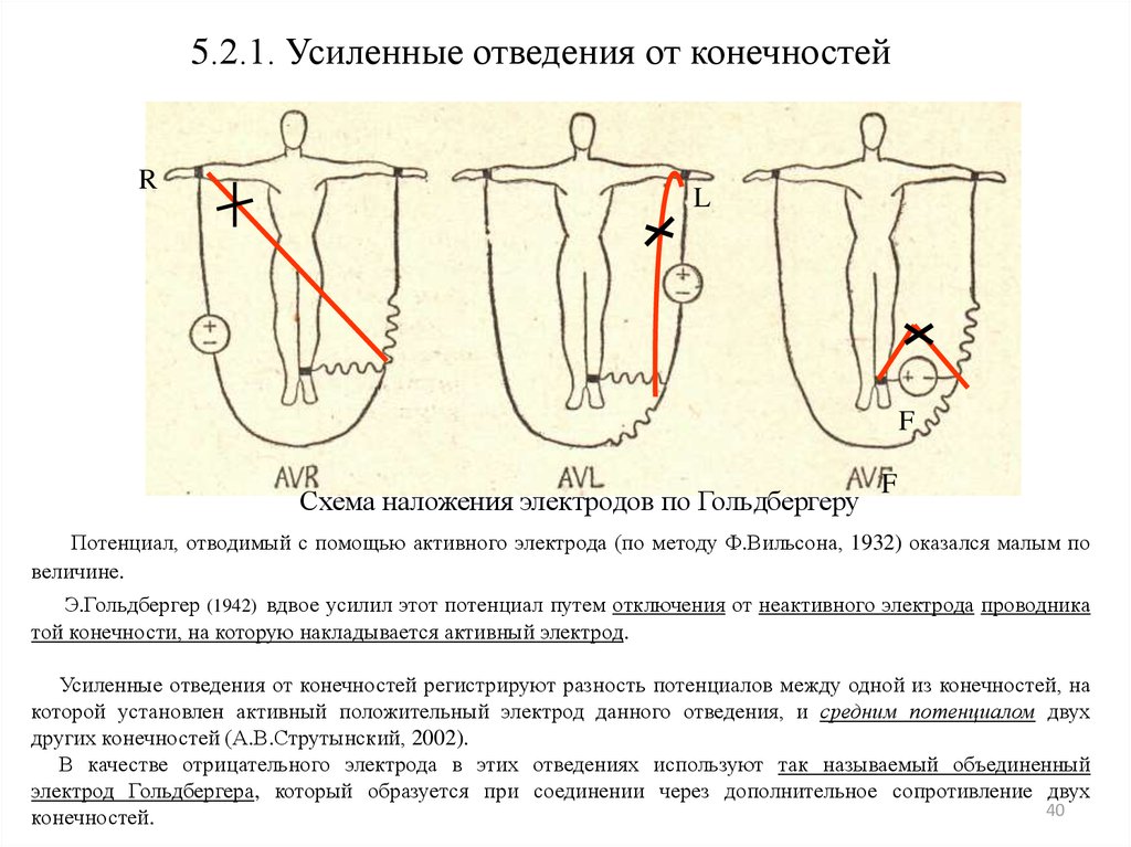 Усиленные отведения экг схема