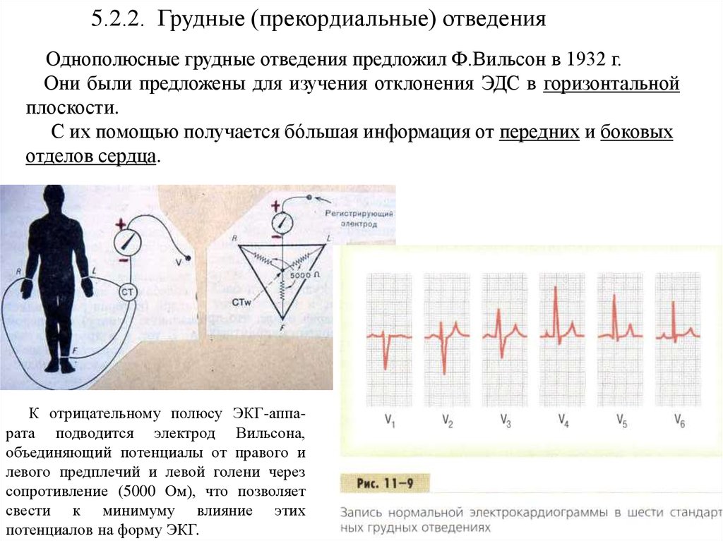 Правые отведения. Дополнительные отведения по Клетену. Грудные однополюсные отведения Вильсона v8. Прекордиальные униполярные отведения по Вильсону. Униполярные грудные отведения по Вильсону.