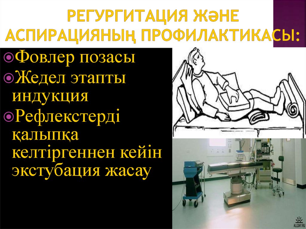 Регургитация және аспирацияның профилактикасы: