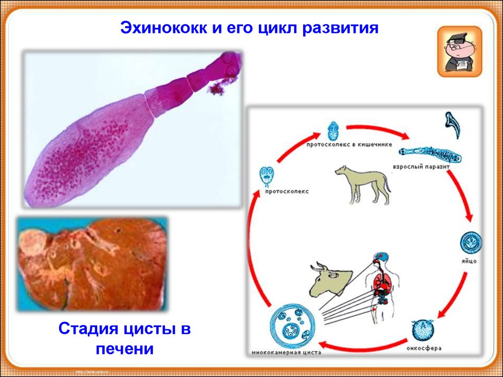 Эхинококк плоский червь