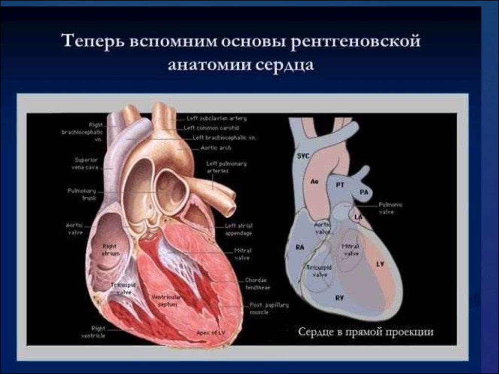 Сердце изменилось. Рентген анатомия сердца. Лучевая анатомия сердца. Лучевая анатомия сердца и крупных сосудов. Лучевая диагностика заболеваний сердца.