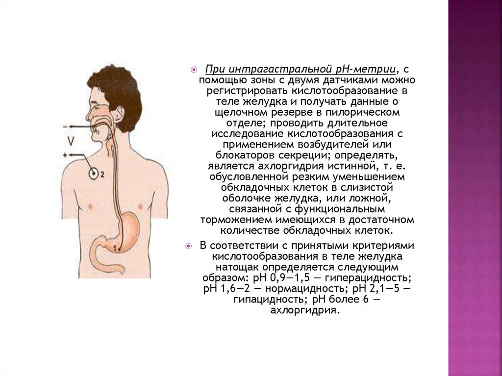 Рн метрия желудка как проводится. Ахлоргидрия желудочного сока. Интрагастральная PH метрия. Желудочная PH метрия в теле желудка. Кислотообразование в желудке.