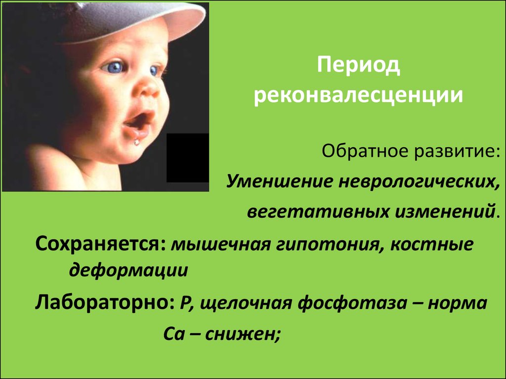 Период снижен. Рахит реконвалесценция. Переизбыток витамина д3 у грудничка симптомы. Передозировка витамина д у грудничков. Период реконвалесценции рахита характеризуется.