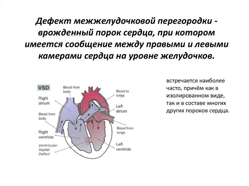 Две камеры сердца