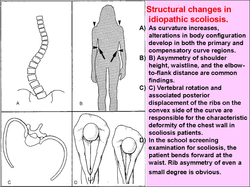 Anatomy of bones in childhood - online presentation