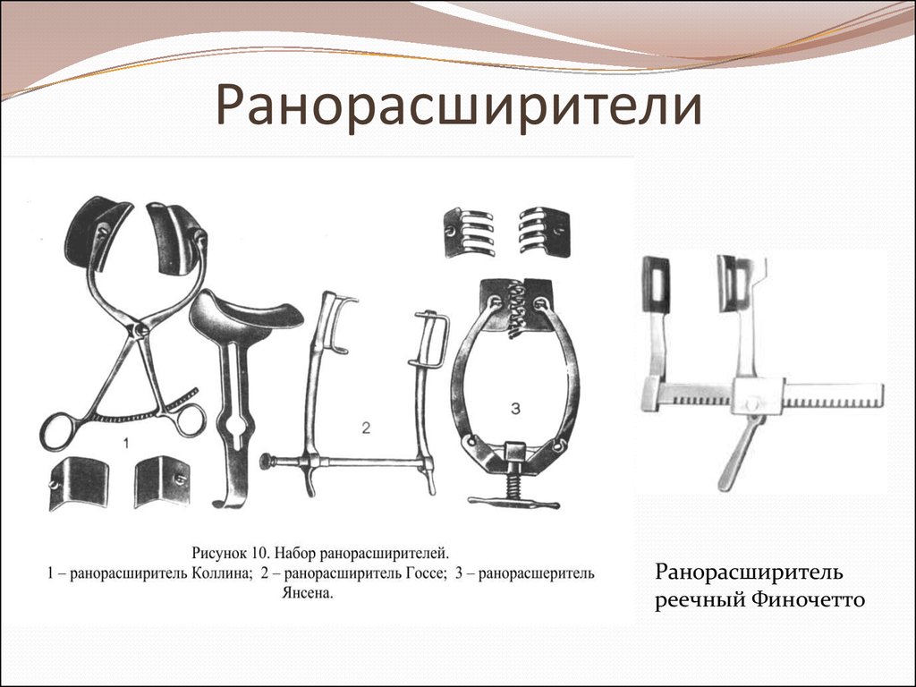 Ранорасширитель микулича фото