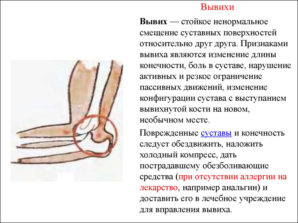 Смещение суставных концов костей относительно друг друга. Пассивные движения в суставе при вывихе. Изменение длины конечности при вывихе. Изменение относительной длины конечности при вывихе.