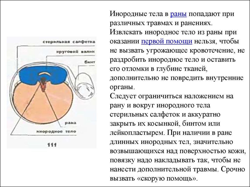 Инородное тело глаза карта вызова скорой помощи медицинской помощи