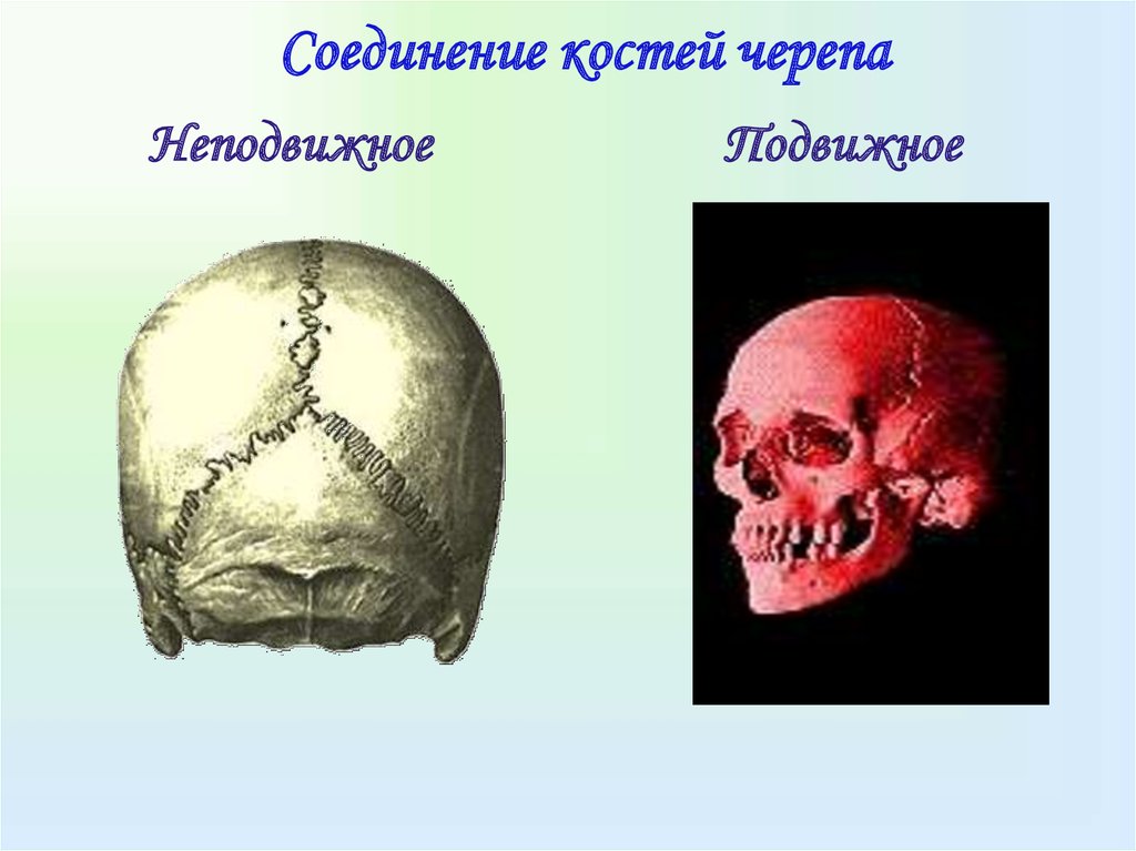 Шов между теменными костями. Соединения костей черепа анатомия швы. Соединение костей мозгового черепа. Соединение костей черепа анатомия. Швы костей черепа.