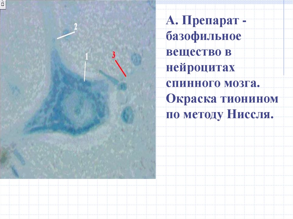 Вещество препарат. Базофильное вещество препарат гистология. Базофильное вещество в нейроцитах спинного мозга. Препарат базофильное вещество в нейроцитах .. Базофильное вещество в нейроцитах спинного мозга препарат.