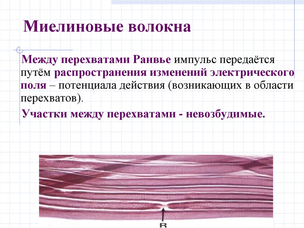 Ткань передающая импульс. Изолированные миелиновые волокна гистология. Миелиновое нервное волокно неврилемма. Перехват Ранвье в миелиновом волокне. Милеиновые мышечные волокна.