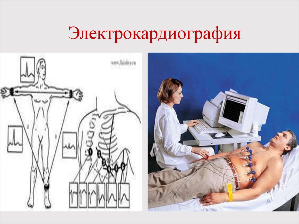 Работа экг. Электрокардиография. Проведение ЭКГ. Регистрация ЭКГ. Фоноэлектрокардиограф.