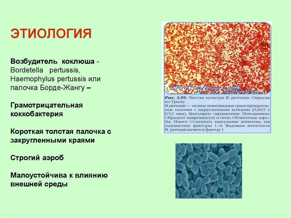 Возбудитель коклюша. Возбудители коклюша бордетеллы. Коклюш характеристика возбудителя. Возбудитель коклюша палочка борде Жангу. Возбудитель коклюша этиология.