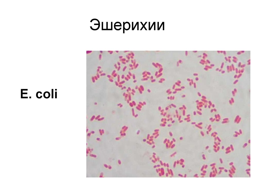 Escherichia coli что это у мужчин. Кишечная палочка окраска по Граму. Диареегенные эшерихии морфология. Escherichia coli окраска по Граму. Эшерихии микробиология.