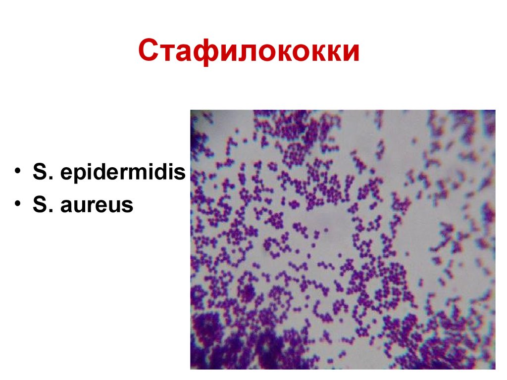 Staphylococcus aureus 10 5